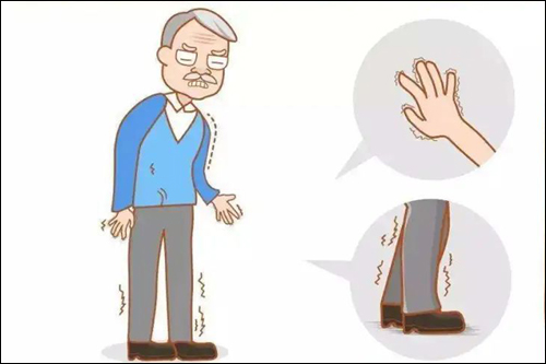 แพทย์จีนเตรียมแผนการรักษาผู้ป่วย“พาร์กินสัน”แบบครบวงจร หลังพบป่วยกว่า 3 ล้านคน